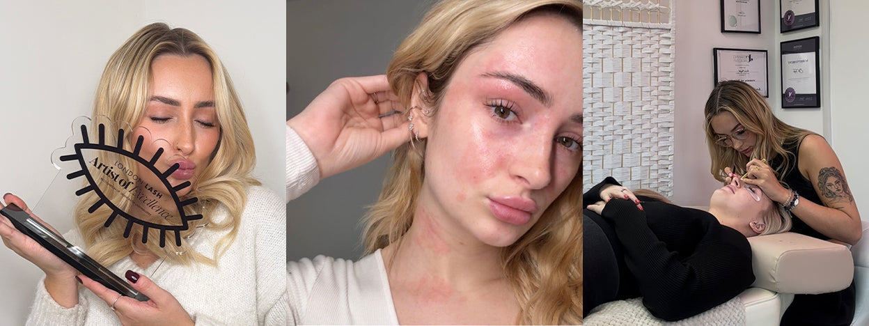 My Lash Glue Allergy Journey: How I Pivoted My Beauty Career